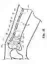 Fig. 35 - Fixation system for orthopedic devices