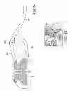 Fig. 02 - PAIN MANAGEMENT WITH STIMULATION SUBTHRESHOLD TO PARESTHESIA