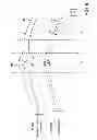 Fig. 07 - PAIN MANAGEMENT WITH STIMULATION SUBTHRESHOLD TO PARESTHESIA