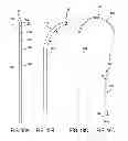 Fig. 09 - PAIN MANAGEMENT WITH STIMULATION SUBTHRESHOLD TO PARESTHESIA