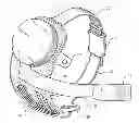 Fig. 01 - Retinal prosthesis
