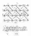Fig. 02 - Stent and Stent Retrieval System and a Method of Pulling a Stent into a Tubular Member