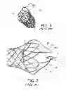 Fig. 02 - INTEGRATED STENT RETRIEVAL LOOP ADAPTED FOR SNARE REMOVAL AND/OR OPTIMIZED PURSE STRINGING