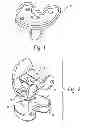 Fig. 02 - Method of designing orthopedic implants using in vivo data