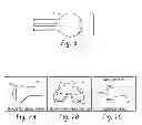 Fig. 06 - Method of designing orthopedic implants using in vivo data