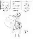 Fig. 07 - Method of designing orthopedic implants using in vivo data