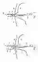 Fig. 07 - APPARATUS INCLUDING MULTIPLE INVAGINATORS FOR RESTORING A GASTROESOPHAGEAL FLAP VALVE AND METHOD
