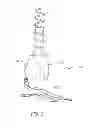Fig. 02 - Transfemoral prosthetic systems and methods for operating the same