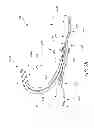 Fig. 05 - Prosthetic foot with dual foot blades and vertically offset toe