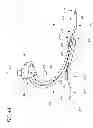 Fig. 07 - Prosthetic foot with dual foot blades and vertically offset toe