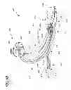 Fig. 08 - Prosthetic foot with dual foot blades and vertically offset toe