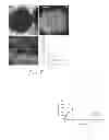 Fig. 09 - MESOPOROUS SILICA NANOPARTICLES SUITABLE FOR CO-DELIVERY