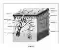 Fig. 02 - Methods of manufacturing devices for generating skin grafts