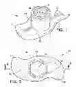 Fig. 02 - Method of Balancing Tires