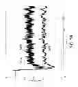 Fig. 85 - Correcting for two-phase flow in a digital flowmeter