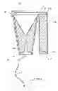 Fig. 05 - Surface blasting product