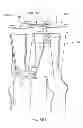 Fig. 06 - Surface blasting product