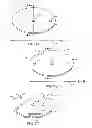 Fig. 02 - Buriable and retrievable anchoring device