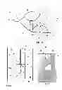 Fig. 04 - Device for protecting a groove in a tread