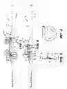 Fig. 02 - Multi-component Anti-extrusion Barrier for a Compression Set Subterranean Barrier