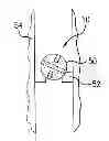 Fig. 01 - Controlled electrolytic degredation of downhole tools