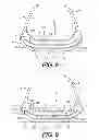 Fig. 07 - Footwear sole sections including bladders with internal flexibility sipes therebetween and an attachment between sipe surfaces