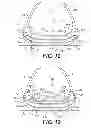 Fig. 09 - Footwear sole sections including bladders with internal flexibility sipes therebetween and an attachment between sipe surfaces