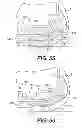 Fig. 43 - Footwear sole sections including bladders with internal flexibility sipes therebetween and an attachment between sipe surfaces