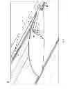 Fig. 04 - Wing control system