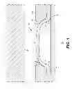 Fig. 02 - Backup system for packer sealing element
