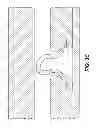Fig. 06 - Backup system for packer sealing element
