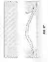 Fig. 09 - Backup system for packer sealing element