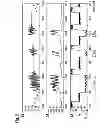 Fig. 03 - Method for Controlling the Pressure in an Electronically Controlled Hydraulic Brake System for a Motor Vehicle