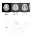 Fig. 03 - Endogenous magnetization contrast in MRI