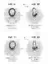 Fig. 07 - High-power-capable circularly polarized patch antenna apparatus and method