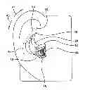 Fig. 01 - Earpiece positioning and retaining