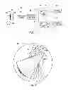 Fig. 03 - System and apparatus for classifying x-ray energy into discrete levels
