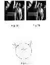 Fig. 06 - METHOD FOR IMAGE PROCESSING AND AN APPARATUS
