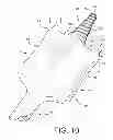 Fig. 08 - Spade bit having reamer feature