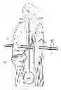 Fig. 01 - Magnetically assisted kinetic turbine system