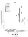 Fig. 07 - DELIVERY SYSTEM FOR DIAGNOSTIC AND THERAPEUTIC AGENTS