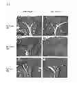 Fig. 05 - CANDIDATES AGAINST INFECTION