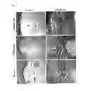 Fig. 07 - CANDIDATES AGAINST INFECTION