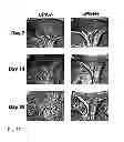 Fig. 12 - CANDIDATES AGAINST INFECTION