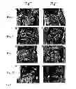 Fig. 15 - CANDIDATES AGAINST INFECTION