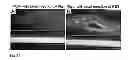 Fig. 19 - CANDIDATES AGAINST INFECTION