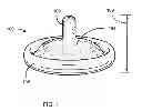 Fig. 02 - Pleasure Enhancing Condom