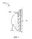 Fig. 04 - Pleasure Enhancing Condom