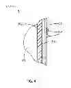 Fig. 05 - Pleasure Enhancing Condom