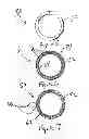 Fig. 04 - APPARATUS AND METHOD FOR THE TREATMENT OF ABNORMAL UTERINE BLEEDING